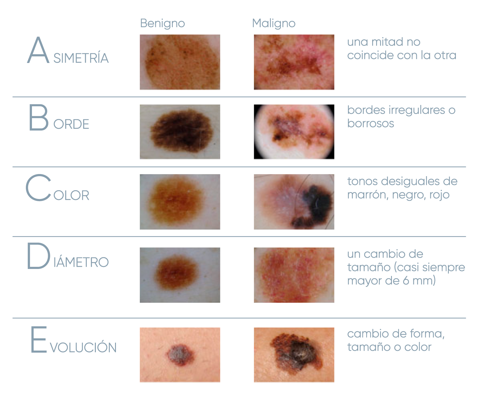 ABCDE DE LOS LUNARES